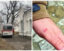 Спочатку знімав на камеру, а потім атакував: священник накинувся на військового та покусав його, як все сталося